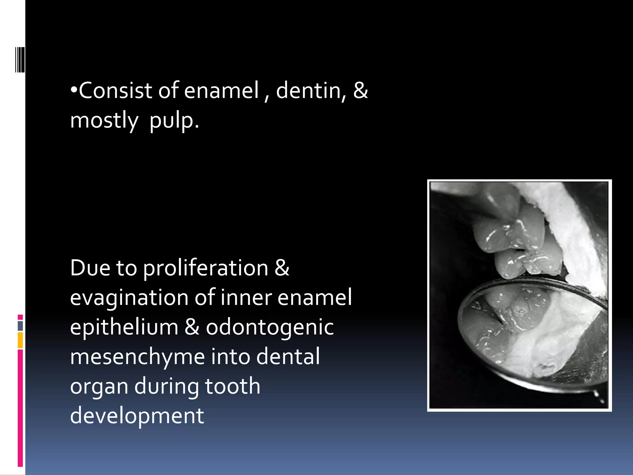 •Consist of enamel , dentin, &
mostly pulp.
Due to proliferation &
evagination of inner enamel
epithelium & odontogenic
mesenchyme into dental
organ during tooth
development
 