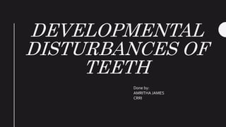 DEVELOPMENTAL
DISTURBANCES OF
TEETH
Done by:
AMRITHA JAMES
CRRI
 