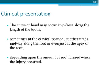 developmental disturbances of teeth.pptx