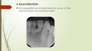 DEVELOPMENTAL DISTURBANCES OF TEETH [Autosaved].pptx