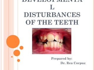 DEVELOPMENTA
      L
DISTURBANCES
 OF THE TEETH




      Prepared by:
           Dr. Rea Corpuz
 