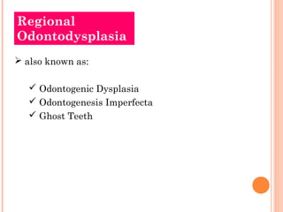 Regional
Odontodysplasia
 also known as:

    Odontogenic Dysplasia
    Odontogenesis Imperfecta
    Ghost Teeth
 