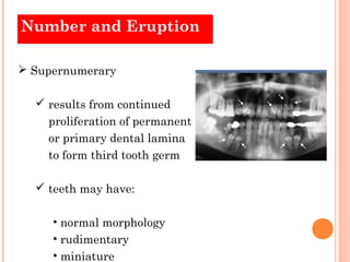 Number and Eruption

 Supernumerary

   results from continued
    proliferation of permanent
    or primary dental lami...