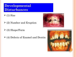Developmental
Disturbances
 (1) Size

 (2) Number and Eruption

 (3) Shape/Form

 (4) Defects of Enamel and Dentin
 