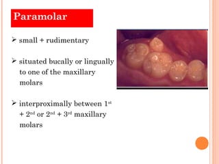 Paramolar

 small + rudimentary

 situated bucally or lingually
  to one of the maxillary
  molars

 interproximally be...
