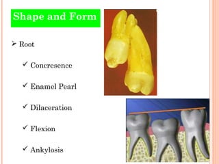 Shape and Form

 Root

   Concresence

   Enamel Pearl

   Dilaceration

   Flexion

   Ankylosis
 