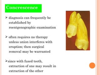 Concrescence

 diagnosis can frequently be
  established by
  roentgenographic examination

 often requires no therapy
 ...