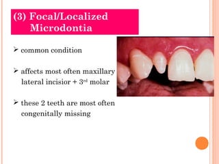 (3) Focal/Localized
    Microdontia

 common condition

 affects most often maxillary
  lateral incisior + 3rd molar

 ...