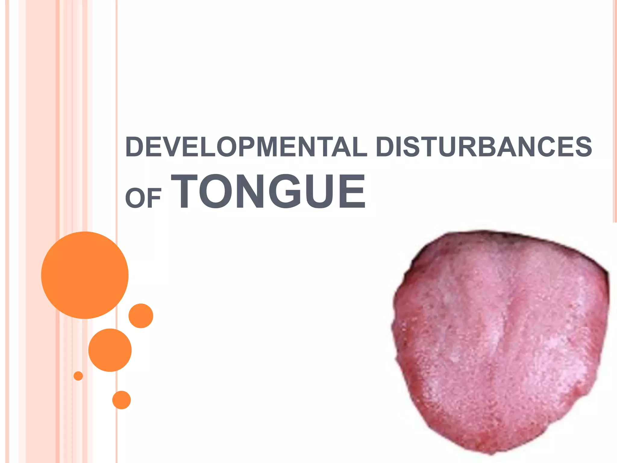 DEVELOPMENTAL DISTURBANCES
OF TONGUE
 