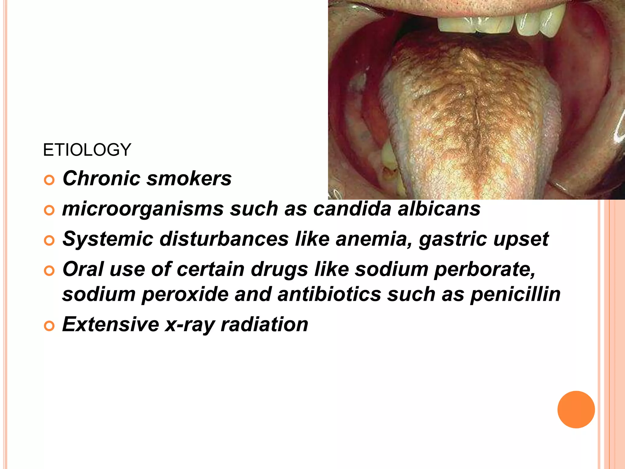 ETIOLOGY
 Chronic smokers
 microorganisms such as candida albicans
 Systemic disturbances like anemia, gastric upset
 Oral use of certain drugs like sodium perborate,
sodium peroxide and antibiotics such as penicillin
 Extensive x-ray radiation
 