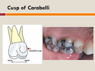 developmental-disturbances-of-tooth-morphology-pdf