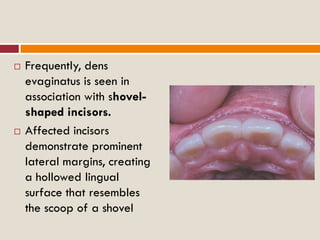 Developmental disturbances of tooth morphology | PDF