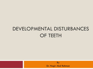 DEVELOPMENTAL DISTURBANCES
OF TEETH
By
Dr. Hagir Abd Rahman
 
