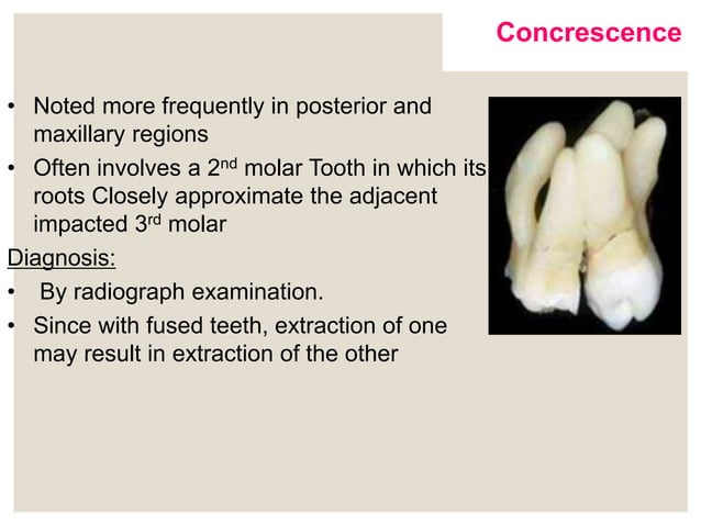 Developmental disturbances shape, size and number of the teeth | PPTX ...