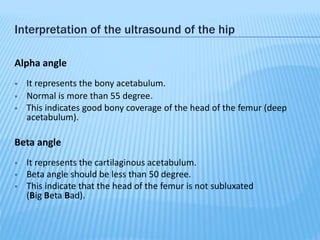 Developmental dysplasia of the hip | PPTX