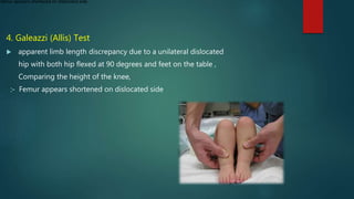 Developmental dysplasia of the hip | PPTX