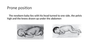 Newborn Positioning DEVELOPMENTAL MILESTONES in Children - Pediatrics | PPTX