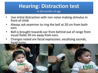 Hearing: Distraction test
6-18 months of age
• Use initial distraction with non noise making stimulus in
front of child
• Always ask examiner to ring the bell at 20 cm from both
ears
• Bell is brought towards ear from behind out of range from
visual fields 20 cm away from ears.
• Changes noted are facial expression, vocalizing sounds,
head turns.
 