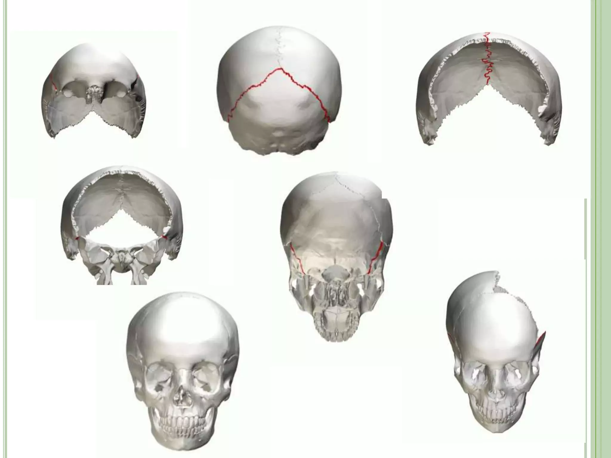 anatomy of human skull | PPTX
