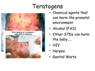 Teratogens 
• Chemical agents that 
can harm the prenatal 
environment. 
• Alcohol (FAS) 
• Other STDs can harm 
the baby….. 
• HIV 
• Herpes 
• Genital Warts 
 