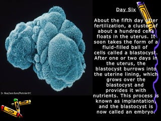 Day Six
About the fifth day after
fertilization, a cluster of
about a hundred cells
floats in the uterus. It
soon takes the form of a
fluid-filled ball of
cells called a blastocyst.
After one or two days in
the uterus, the
blastocyst burrows into
the uterine lining, which
grows over the
blastocyst and
provides it with
nutrients. This process is
known as implantation,
and the blastocyst is
now called an embryo.
 