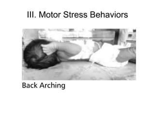 III. Motor Stress Behaviors
 