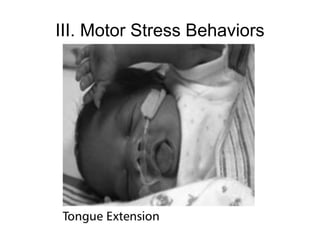 III. Motor Stress Behaviors
 