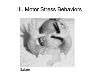 III. Motor Stress Behaviors
 