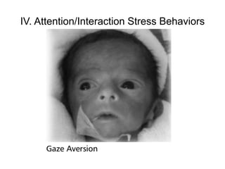 IV. Attention/Interaction Stress Behaviors
 