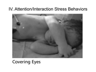 IV. Attention/Interaction Stress Behaviors
 
