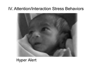 IV. Attention/Interaction Stress Behaviors
 