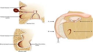 Development and Basic Applied Anatomy of the Ear.pptx