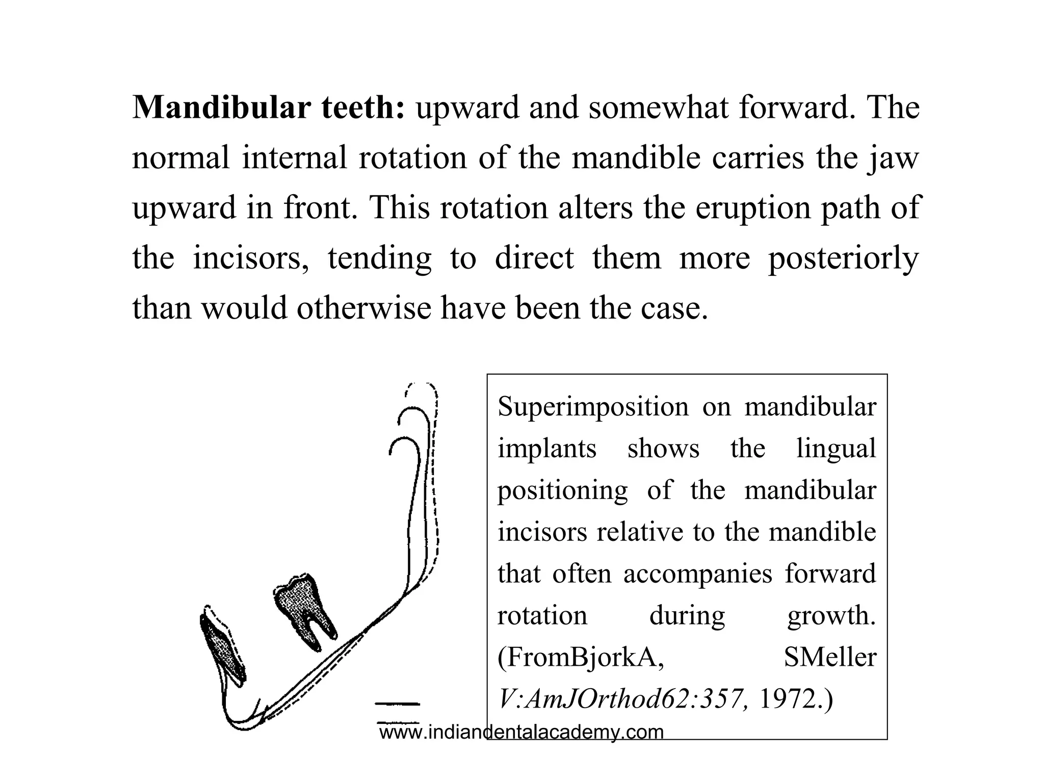 Superimposition on mandibular
implants shows the lingual
positioning of the mandibular
incisors relative to the mandible
that often accompanies forward
rotation during growth.
(FromBjorkA, SMeller
V:AmJOrthod62:357, 1972.)
Mandibular teeth: upward and somewhat forward. The
normal internal rotation of the mandible carries the jaw
upward in front. This rotation alters the eruption path of
the incisors, tending to direct them more posteriorly
than would otherwise have been the case.
www.indiandentalacademy.com
 