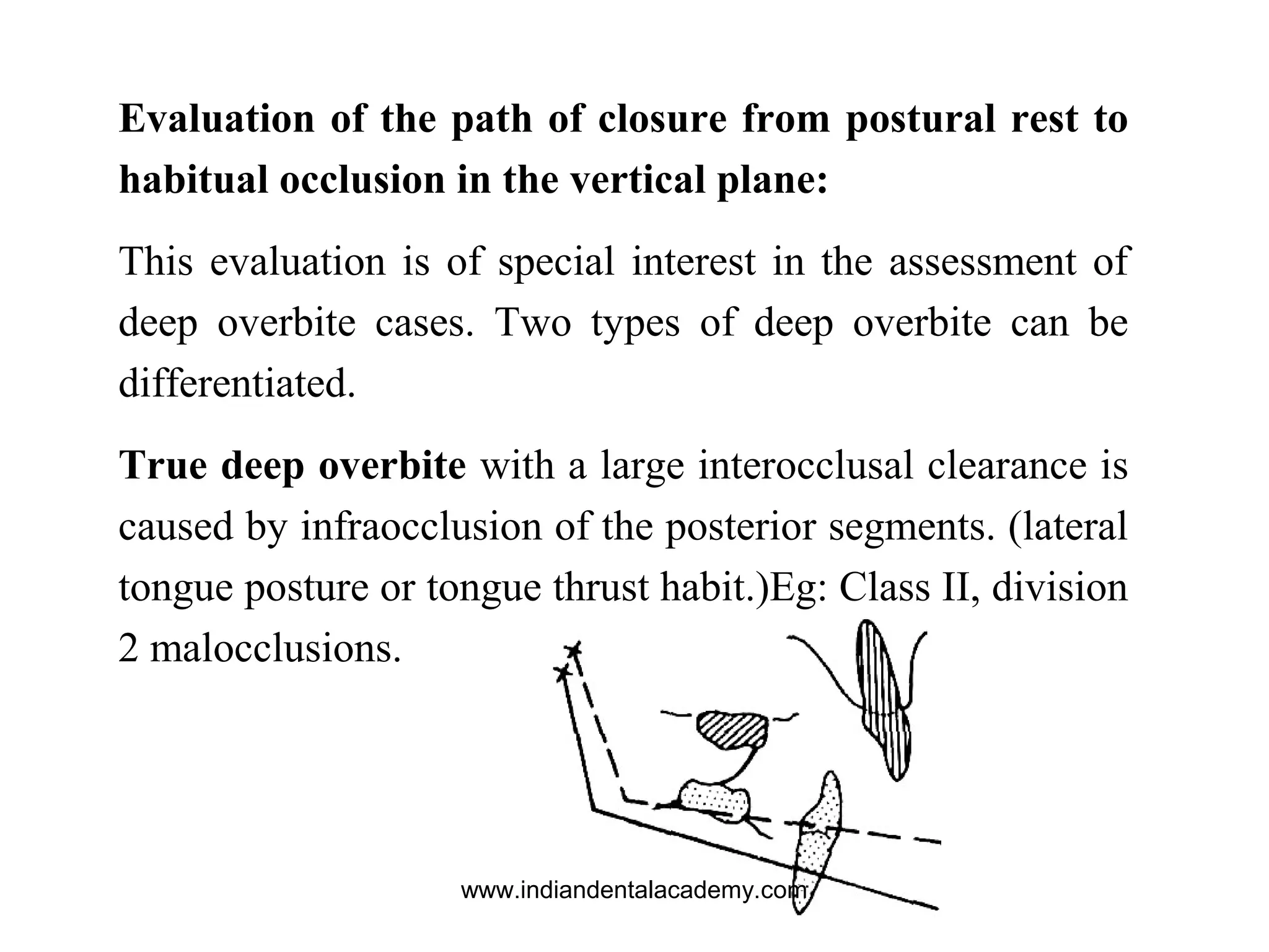 Evaluation of the path of closure from postural rest to
habitual occlusion in the vertical plane:
This evaluation is of special interest in the assessment of
deep overbite cases. Two types of deep overbite can be
differentiated.
True deep overbite with a large interocclusal clearance is
caused by infraocclusion of the posterior segments. (lateral
tongue posture or tongue thrust habit.)Eg: Class II, division
2 malocclusions.
www.indiandentalacademy.com
 