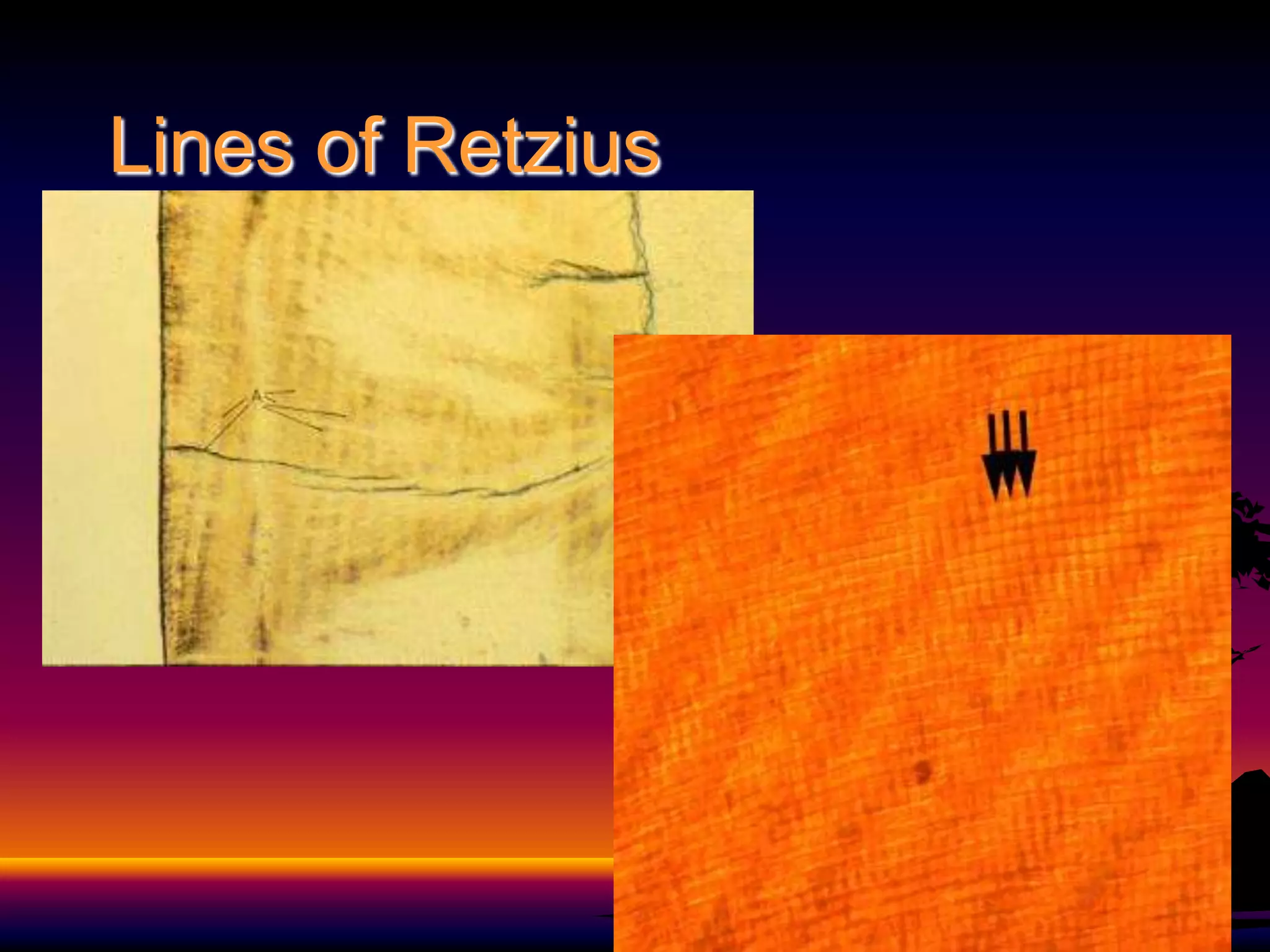 Tooth Retzius Development and morphology of primary teeth | PPT