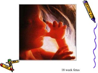18 week fetus
 