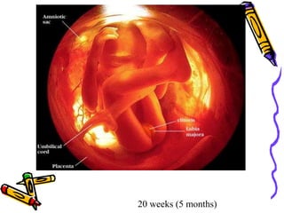 20 weeks (5 months)
 