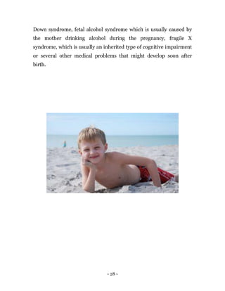- 28 -
Down syndrome, fetal alcohol syndrome which is usually caused by
the mother drinking alcohol during the pregnancy, fragile X
syndrome, which is usually an inherited type of cognitive impairment
or several other medical problems that might develop soon after
birth.
 