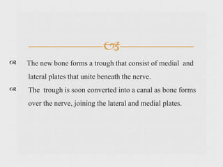 
The new bone forms a trough that consist of medial and
lateral plates that unite beneath the nerve.
The trough is soon converted into a canal as bone forms
over the nerve, joining the lateral and medial plates.
 