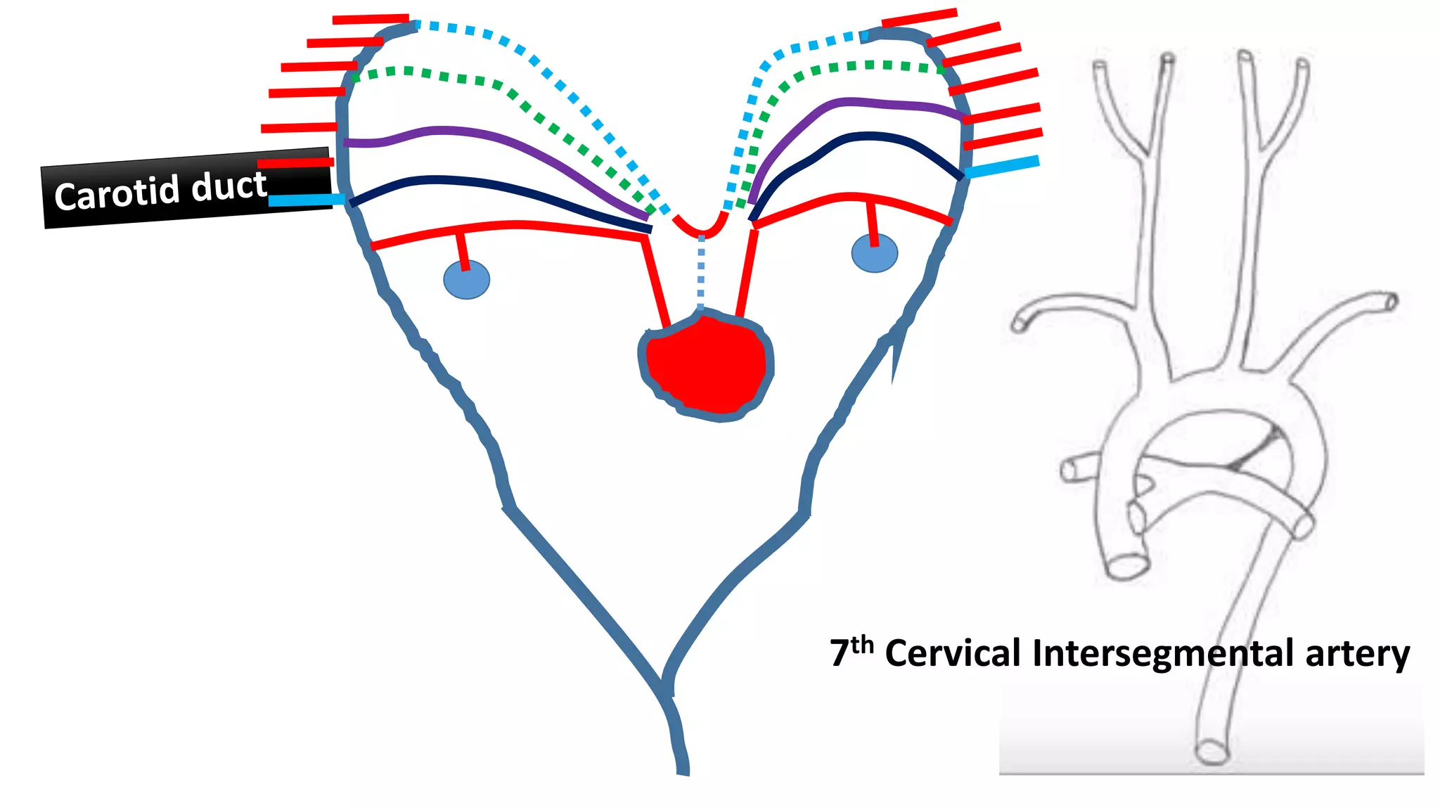 7th Cervical Intersegmental artery
 