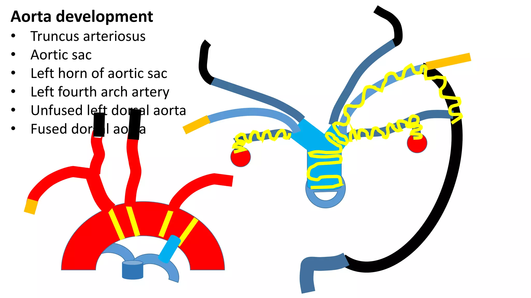Aorta development
• Truncus arteriosus
• Aortic sac
• Left horn of aortic sac
• Left fourth arch artery
• Unfused left dorsal aorta
• Fused dorsal aorta
 