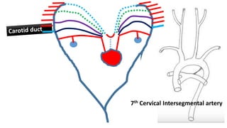 7th Cervical Intersegmental artery
 