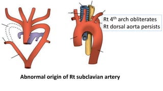 Abnormal origin of Rt subclavian artery
Rt 4th arch obliterates
Rt dorsal aorta persists
 