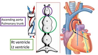 Rt ventricle
Lt ventricle
Ascending aorta
Pulmonary trunk
 