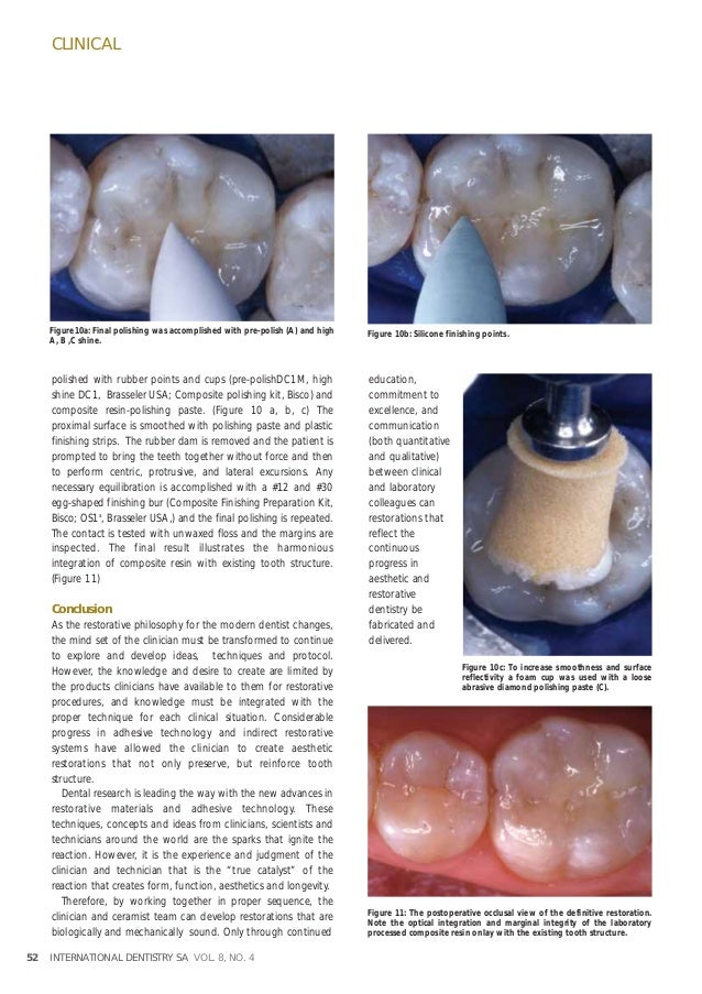 Development of a processed composite restoration