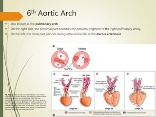 6th Aortic Arch
 also known as the pulmonary arch
 On the right side, the proximal part becomes the proximal segment of the right pulmonary artery.
 On the left, the distal part persists during intrauterine life as the ductus arteriosus
Fig. 4.2 (a) Cardiac neural crest cells (CNCCs) in the outflow
cushions. Cross-section through the distal and middle outflow
tract shows position of the condensed CNCC-derived
mesenchyme within the cushions to form the future aorta (a)
and pulmonary trunk (p). (b) Stages of outflow septation in the
chick. (a) U-shaped septation complex straddles the aortic sac
between the 4th and 6th aortic arch arteries. (b) The septation
complex grows at the expense of the prongs. (c) Septation of
the conus (Adapted from Hutson and Kirby
 