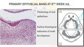 PRIMARY EPITHELIAL BAND AT 6TH WEEK IUL
Thickening of oral
epithelium.
Earliest histological
indication of tooth
development.
 