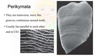 Perikymata
• They are transverse, wave like
grooves, continuous around tooth.
• Usually lies parallel to each other
and to CEJ.
 