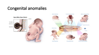 Congenital anomalies
 