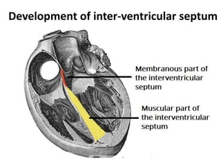 Development of inter-ventricular septum
 